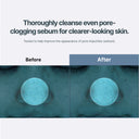 Azulene Acne Foam Cleanser