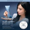 Azulene Acne Foam Cleanser