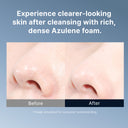Azulene Acne Foam Cleanser